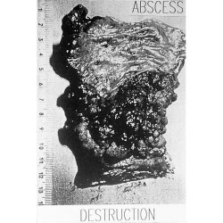 Abscess - Destruction (2016) [Remastered]