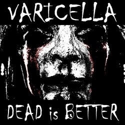 Varicella - Dead Is Better (2018)