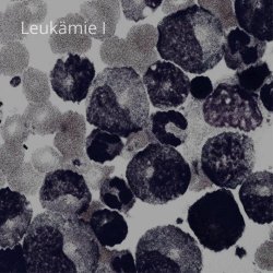 Black.N - Leukämie I (2022) [EP]