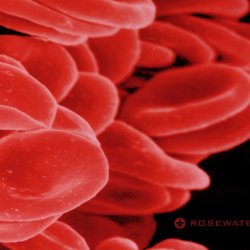 Rosewater - Bloodcount (2006)