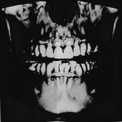 Hypersomnia - Fractured (2026) [Single]