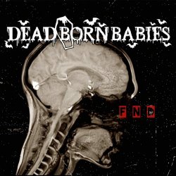 Dead Born Babies - F N D Leave Me Alone (2026) [Single]
