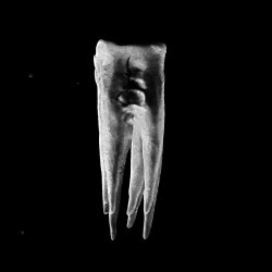 Chalk Teeth - Chalk Teeth (2026)